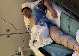 Injury Forces Cro Cop Out of Bellator 200 Fight in London