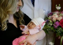 Croatian Miracle: Baby Maša One of Three in the World to Survive Groundbreaking Surgery