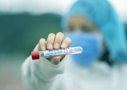 Croatia confirms 96 new Covid cases in the last 24 hours 