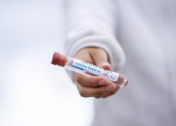 Croatia reports 116 new Covid-19 cases today, new measures to be imposed 