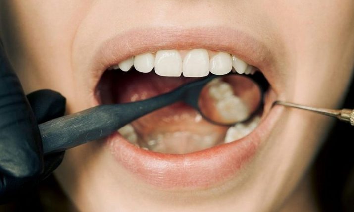 No more black fillings in Croatia under rules